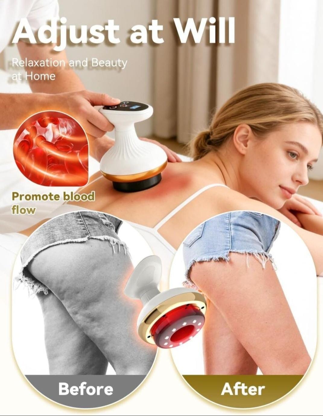 4-in-1 Electric Cellulite Massager – Vacuum, Heat & Roller Body Sculptor